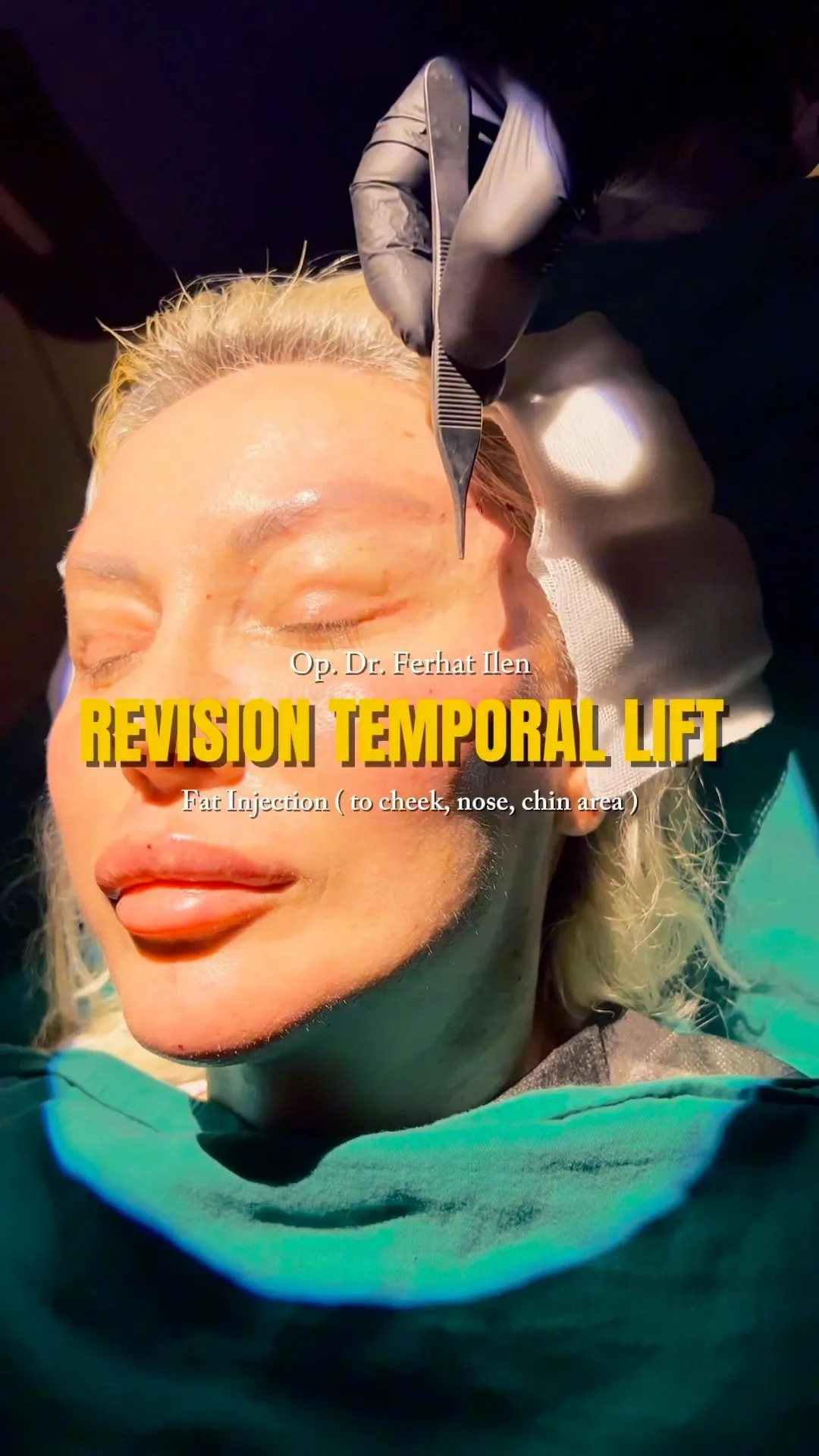 img-video
