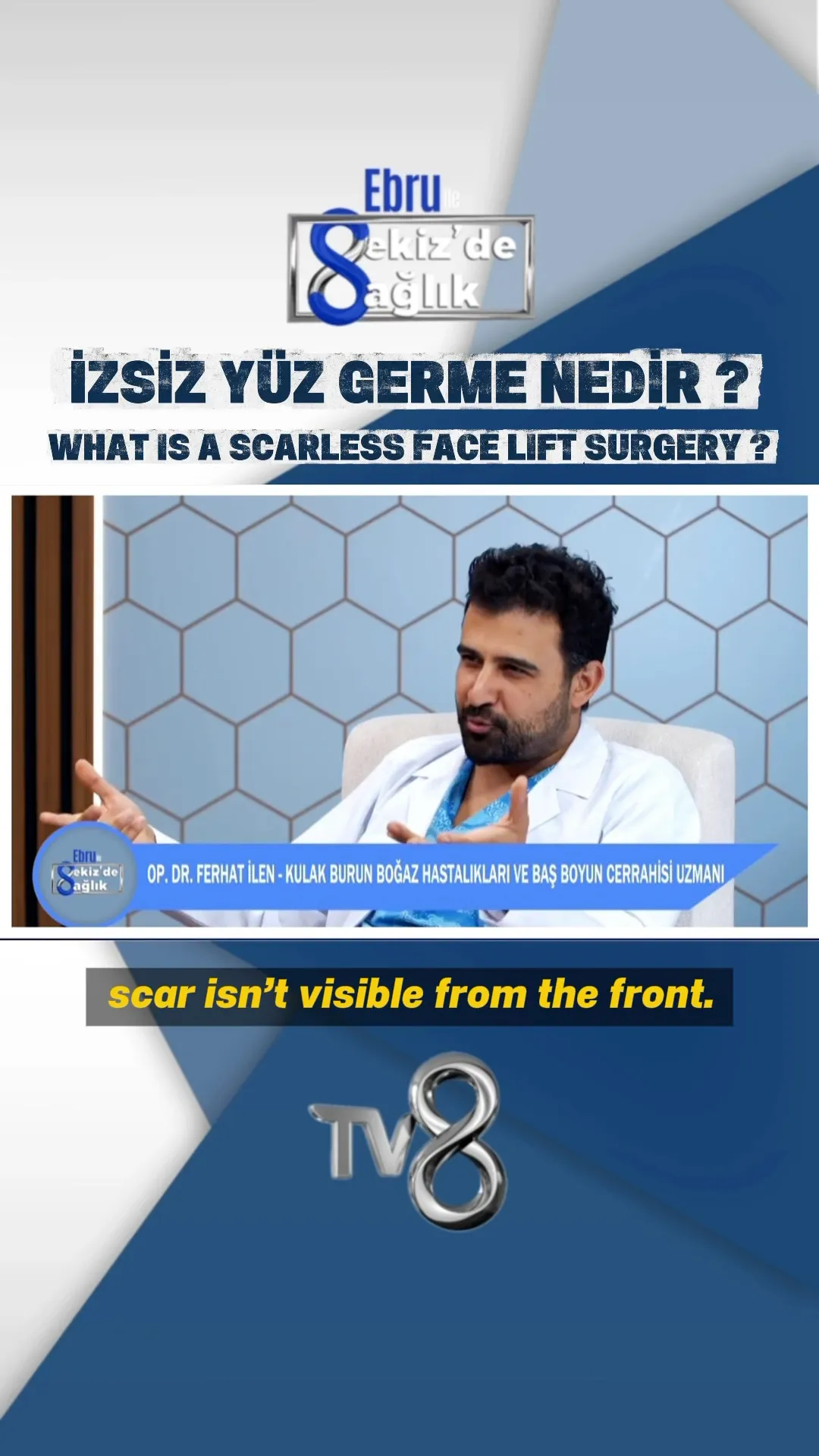 img-video