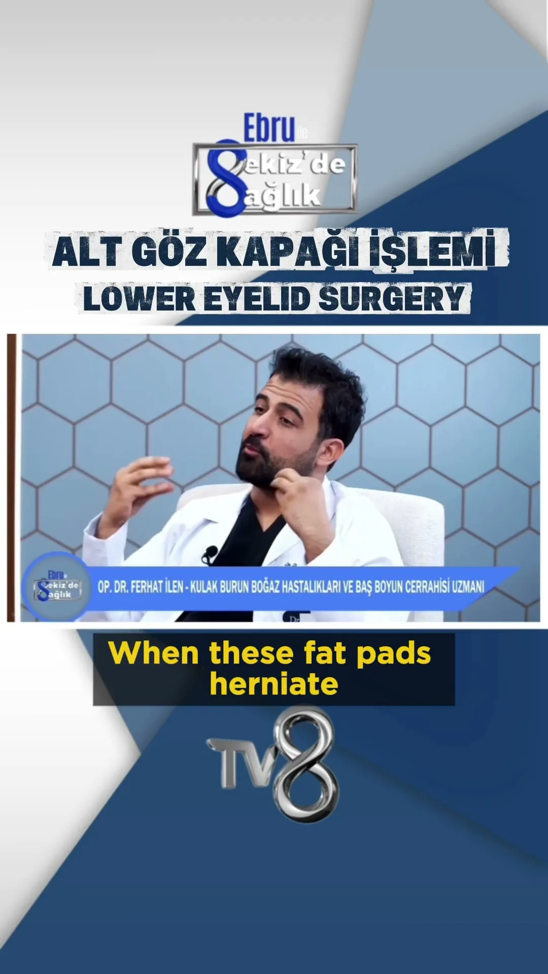 img-video