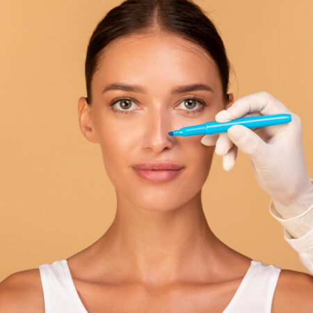 rhinoplasty-concept-doctor-making-marks-on-patien-2022-10-14-18-44-26-utc