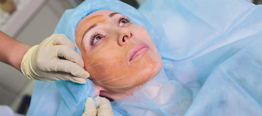 Lifting endoscópico de tercio medio facial y región temporal en plano profundo (Técnica especial)