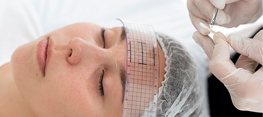Injerto facial de micrograsa y nanograsa